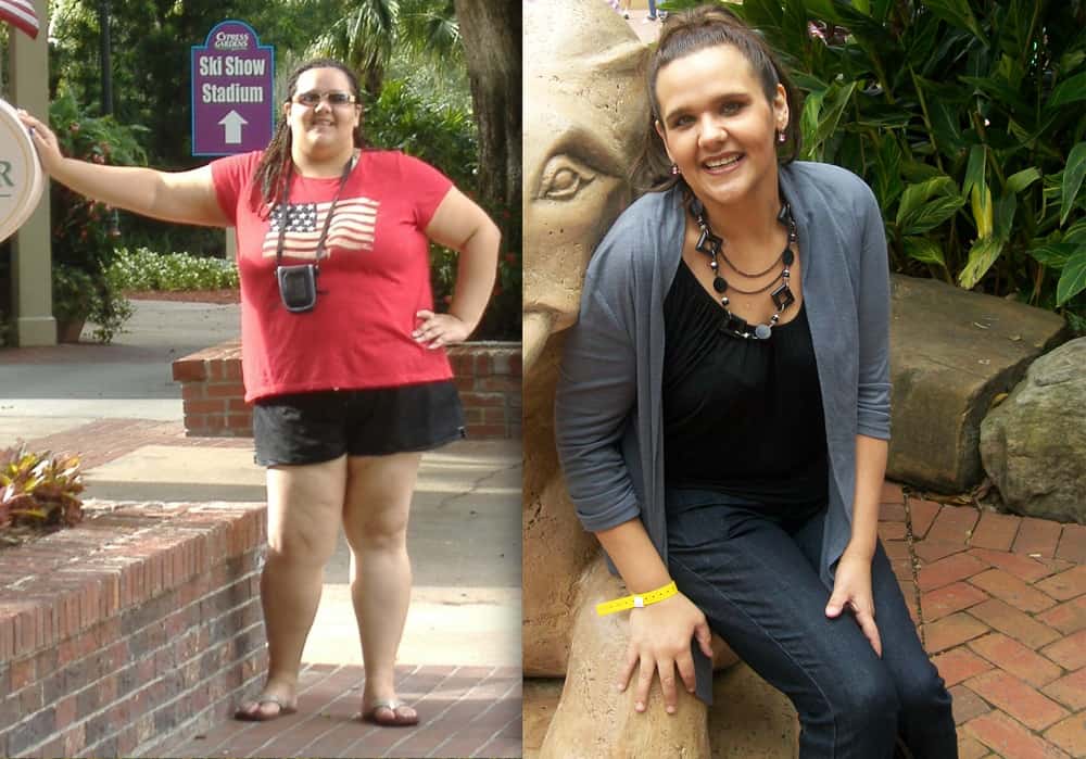 Rebecca Weight Loss Surgery Testimonial
